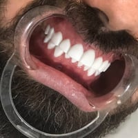 ابتسامة مشاهير • لومينا دنت • السابعة مقابل المولى