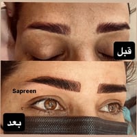 تحويل تاتو • تاتو شعيرات • فايبروز