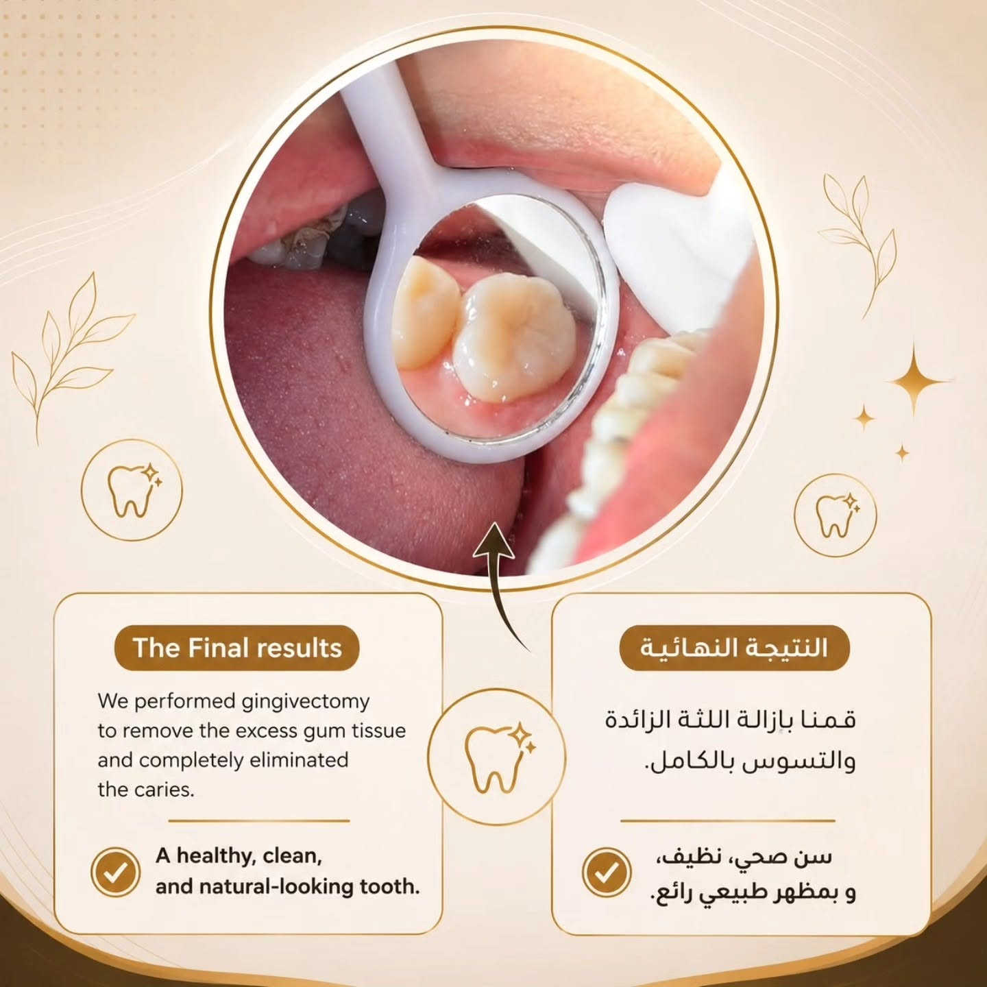 رقم الحجز :***********
علما ان العلاج ب أسعار رمزية جدااا🔥🔥
