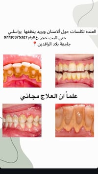 جامعة بلاد الرافدين • تنظيف أسنان • مجاني