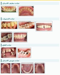 علاج مجاني • اطباء اسنان • كربلاء السعدية