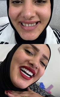مختبر أسنان • تركيب أسنان • خدمة منزلية