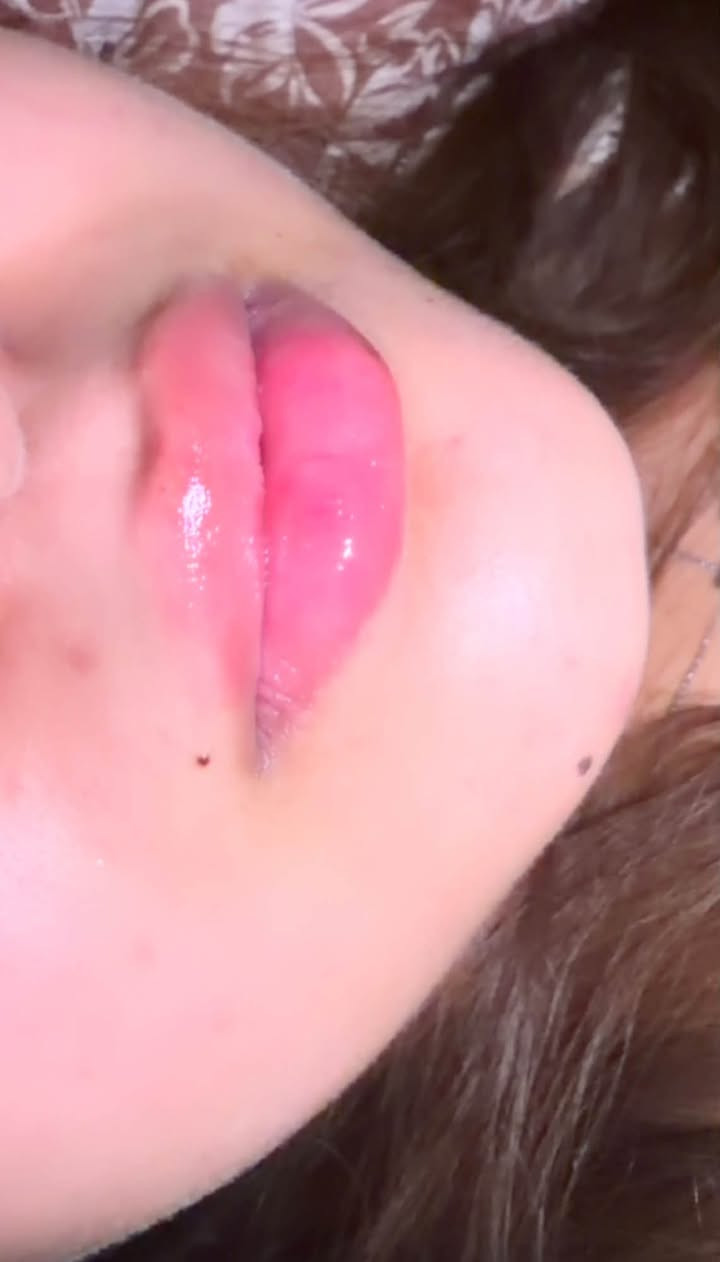 � شفايف أكثر امتلاءً… بتناسق طبيعي وأنيق ✨

فلر الشفاه في Evora Clinic
لإبراز جمال الشفاه وتحديد الكونتور بطريقة ناعمة ومدروسة 🤍

✨ زيادة الامتلاء بشكل متناسق
✨ تحديد وتنسيق شكل الشفاه
✨ تحسين التناسق بين الشفة العلوية والسفلية
✨ إطلالة ناعمة وطبيعية بدون مبالغة

لأن الجمال مو بالامتلاء فقط…
الجمال بالتناسق ✨

📍 حي الجامعة – قرب صيدلية السوسن
📞 ***********

Evora Clinic | عيادة إيفورا
جلدية • تجميل غير جراحي • ليزر@إشارة
