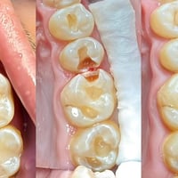 عيادة أونو • تجميل الأسنان • الديوانية