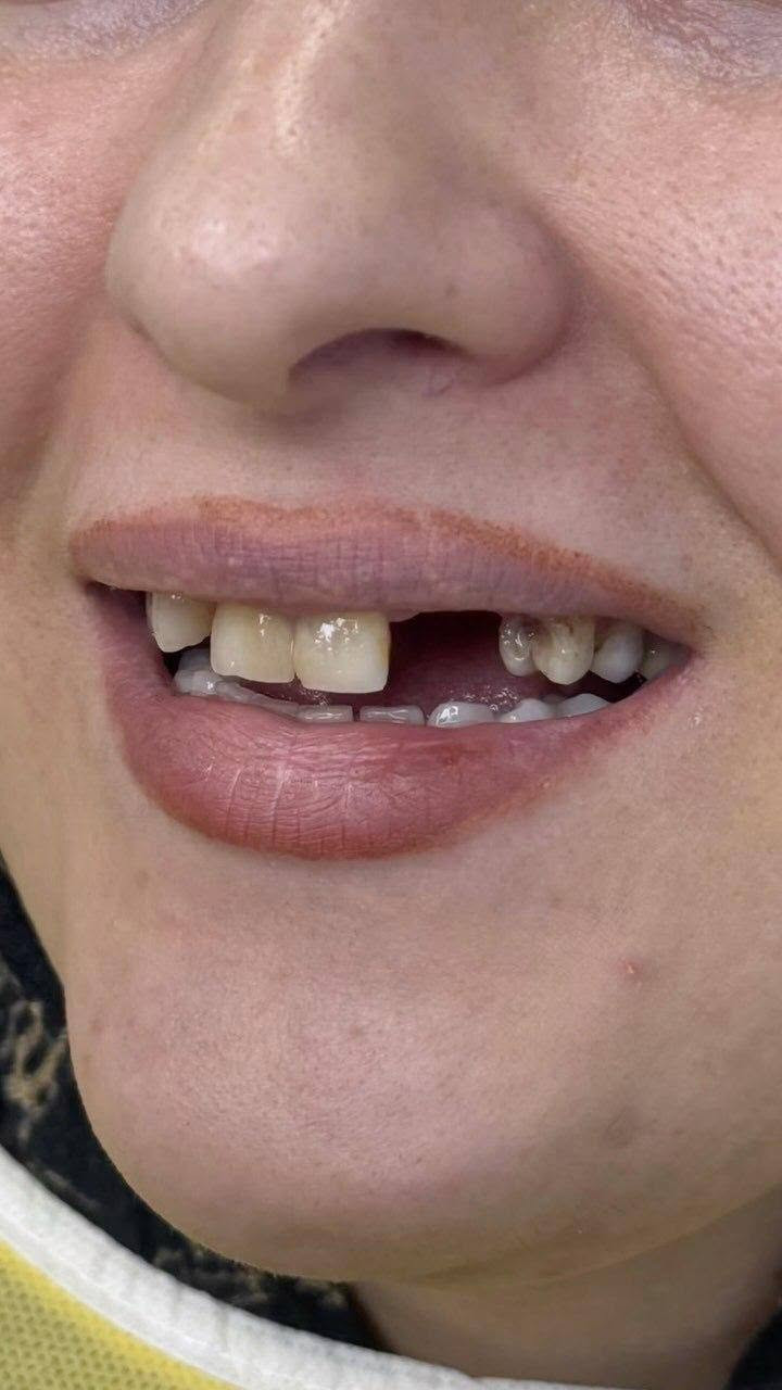 تجميل أسنان • الزعفرانية • مركز سما