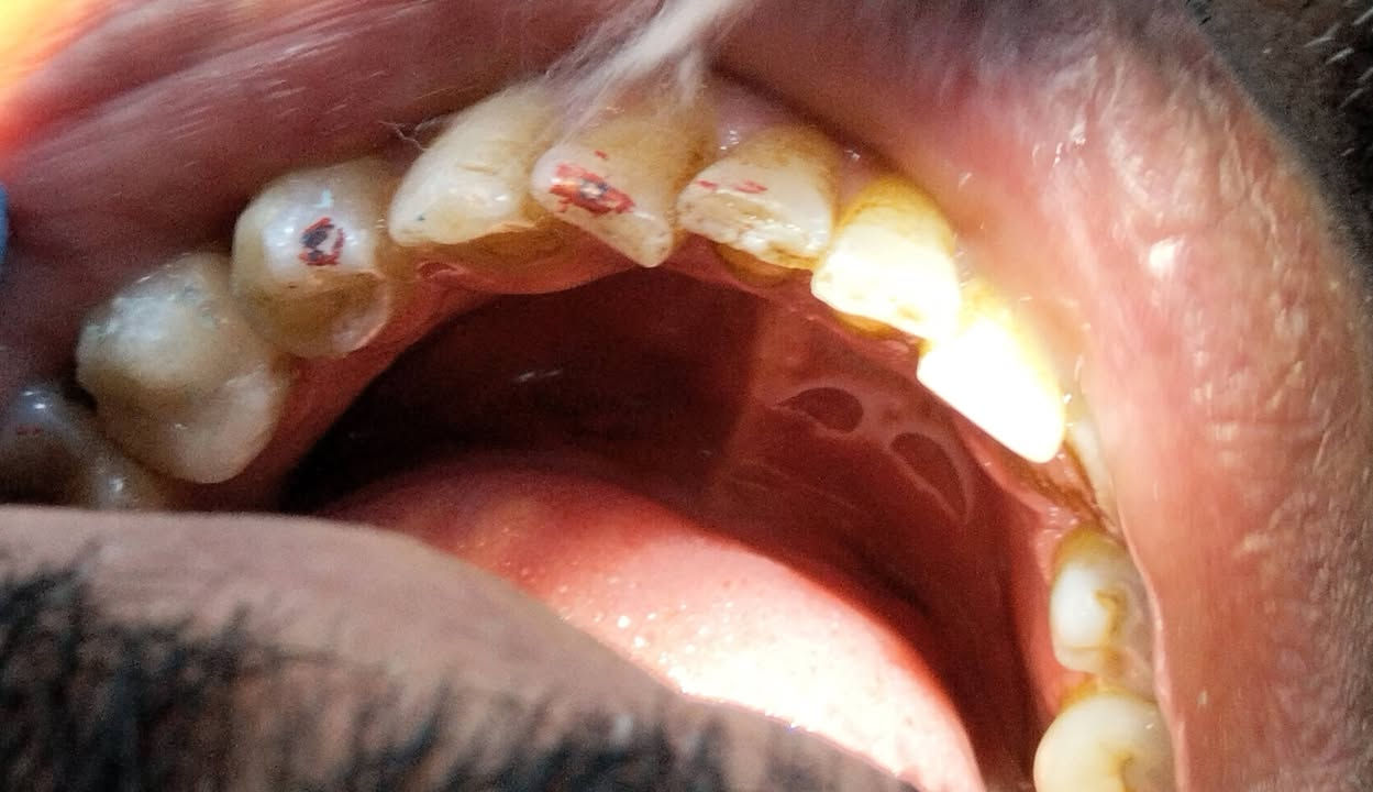 زورونا في العيادة⬇️
https://maps.app.goo.gl/eSWR3uLEtUrSx6hU9?g_st=ac
ولحجز و الاستفسار الاتصال على الرقم التالي ⬇️
***********
