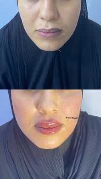 تغيير شامل • فلر • الناصرية سوق الشيوخ