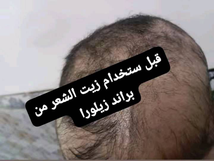 زيت شعر  مناسب لجميع الاعمار ب25,000
توصيل لكل محافظات هذا رقمي ***********
