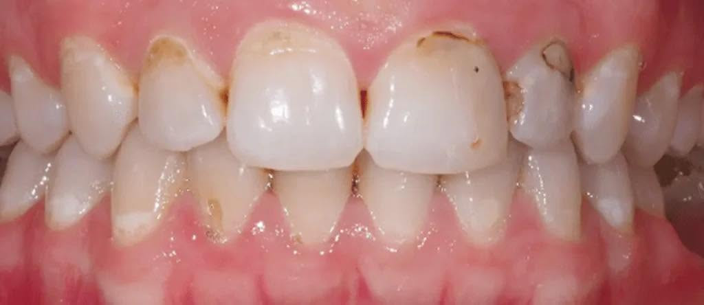 ابتسامتك تستحق عناية تليق بها
نقدّم لكم خدمات طب الأسنان في عيادات طب الأسنان - جامعة الكوفة، باهتمام ودقة وحرص على راحتكم.
خلف كلية الفقه
نظيف الأسنان وازالة التكلسات
حشوات تجميلية
تعويض الأسنان المفقودة
قلع الأسنان التالقة
والجذور المتبقية
***********
n.our.1_

نص مكتوب في الصور:
- drgabrielwahyudi