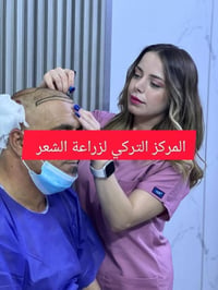 زراعة شعر • تقنية DHI • اقساط ١٠ اشهر