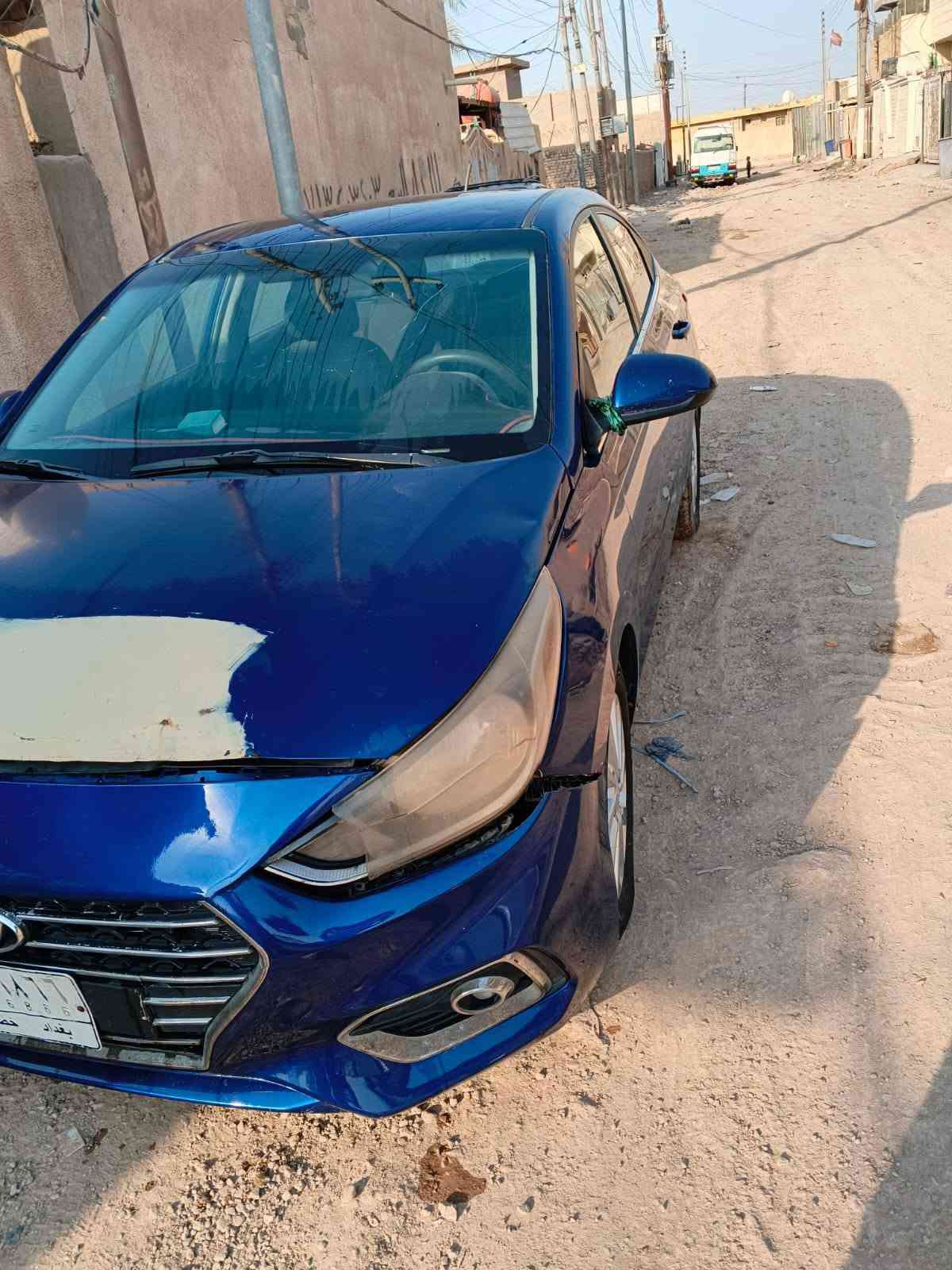 السلام عليكم سيارة اكسنت 2021 وارد أمريكي الضرر كما موضح بالصور والسونار موجود أيضا + ضربه في البنيد بالعراق وضرر بالدعامية باقي كفاله مكينه دوش كير مكفول سياره معوقين بعد سنه وتنفك تحب حتى وكالة عامه اسوي رقم بغداد وايي استفسار ‏‪***********‬‏ السعر 80 ورقة
