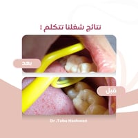 الشلالات جامعة النور • حشوات ضوئية • مجاناً