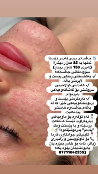 جلسة بيبي فيس • توحيد لون • عيادة فارما