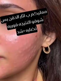 ماتركس عبير • شد نضارة • عرض ٥٠٪