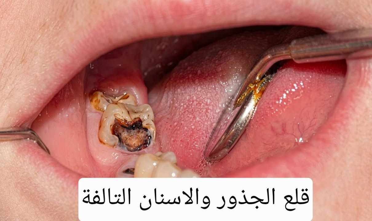 علاج أسنان • مجاني • كربلاء الحر الصغير