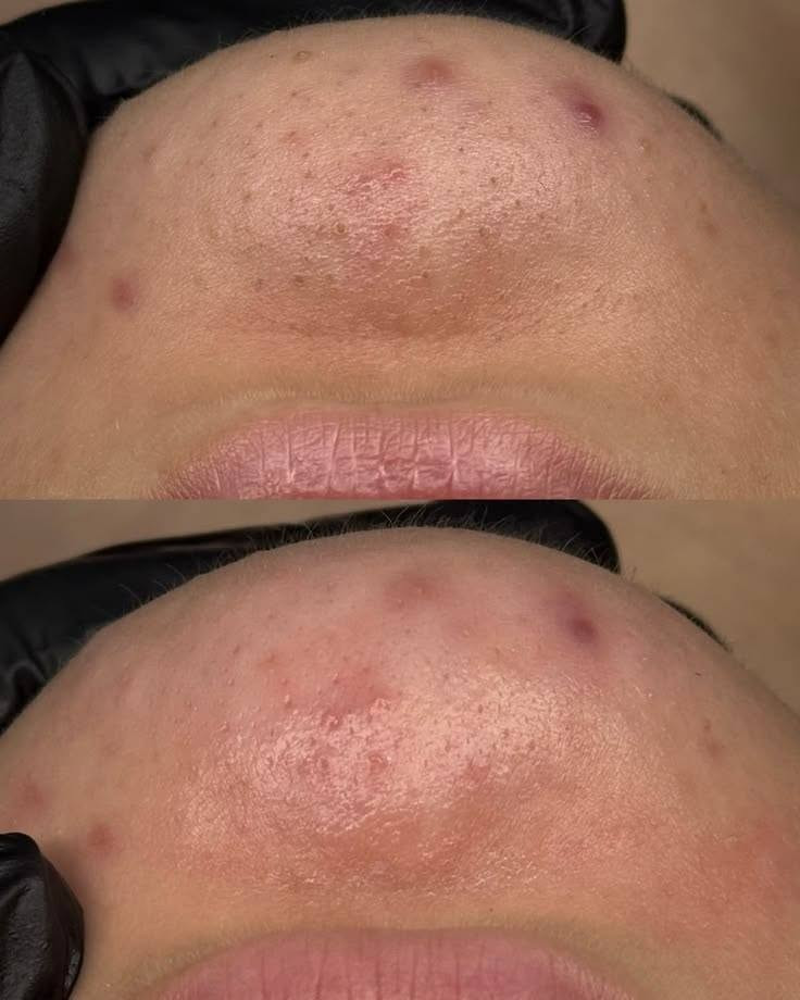 دار آيار للتجميل والعنايه بالبشره والجسم والشعر والاظافروالليزر ***********
