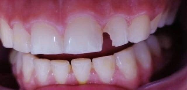 تسوس • علاج مجاني • جامعه المستقبل