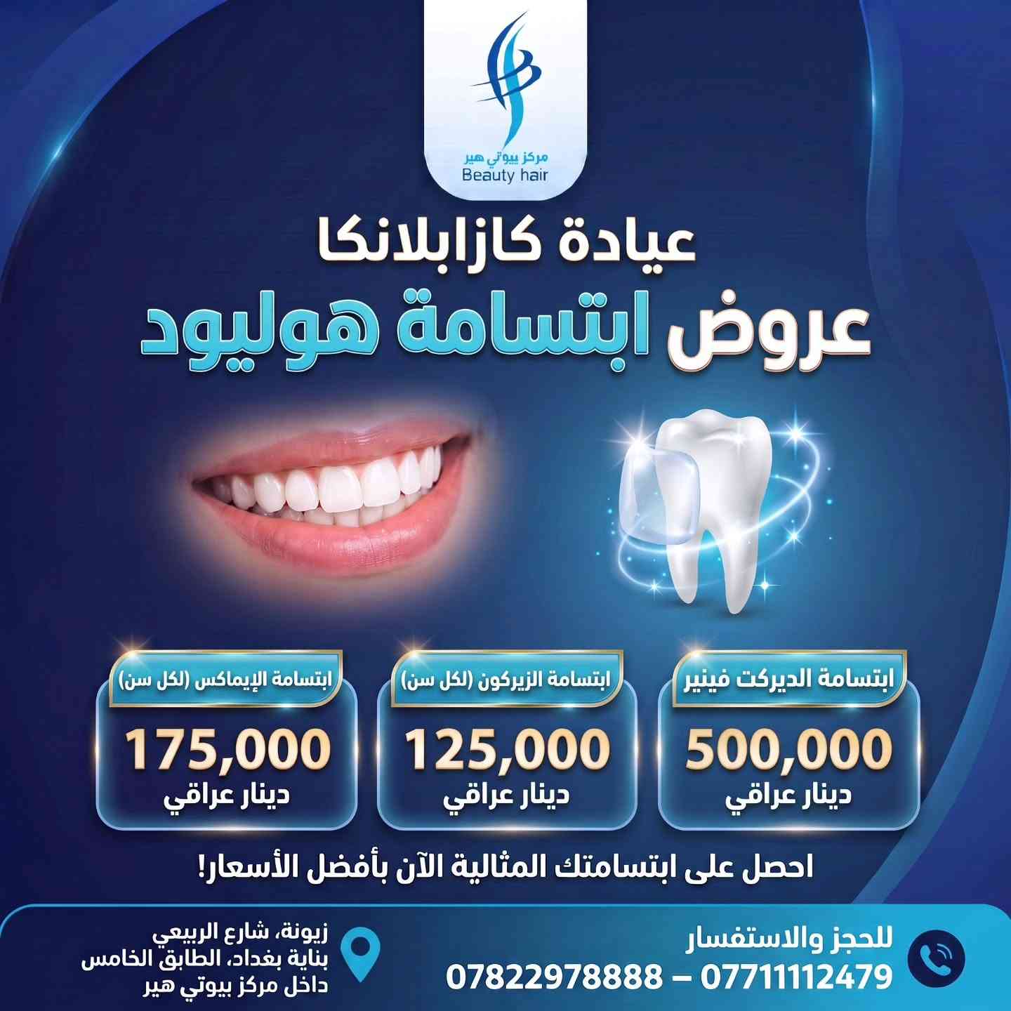 ابتسامة هوليوود • زراعة أسنان • زيونة