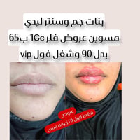 جم ليدي • فلر 1cc • ليزر كاندلا