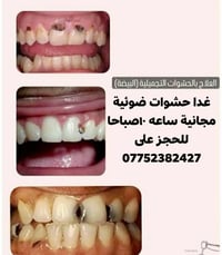 مجاني • حشوات ضوئية • غدا ١٠ص