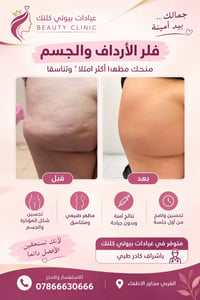 فلر الأرداف • فلر الجسم • بإشراف طبي