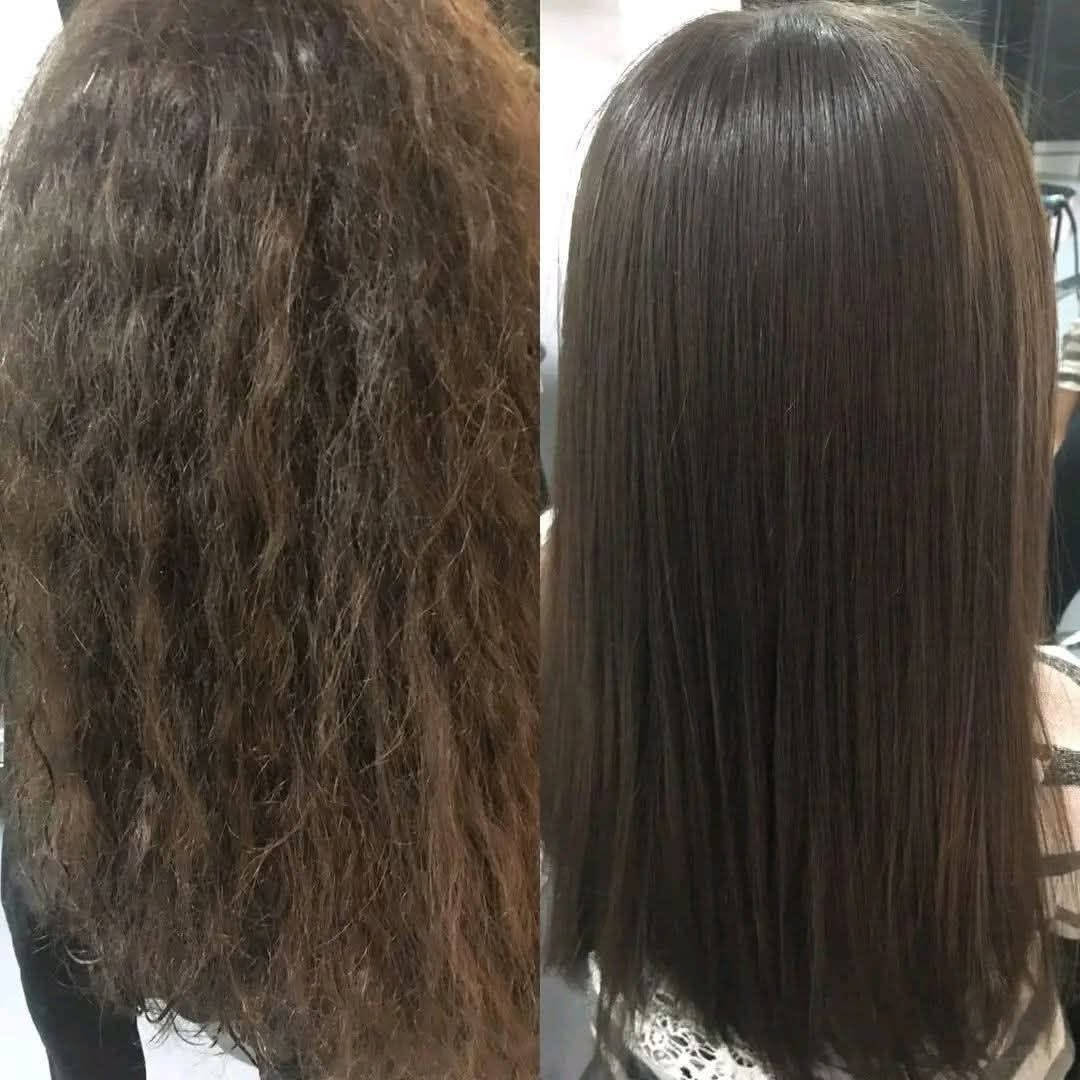 قبل مركز لوجي • تجميل • خاص