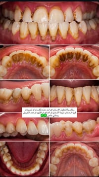 مرحبا اللي عنده هذه المشاكل باسنانه ومحتاج علاج بأحسن المواد وتحت إشرا...