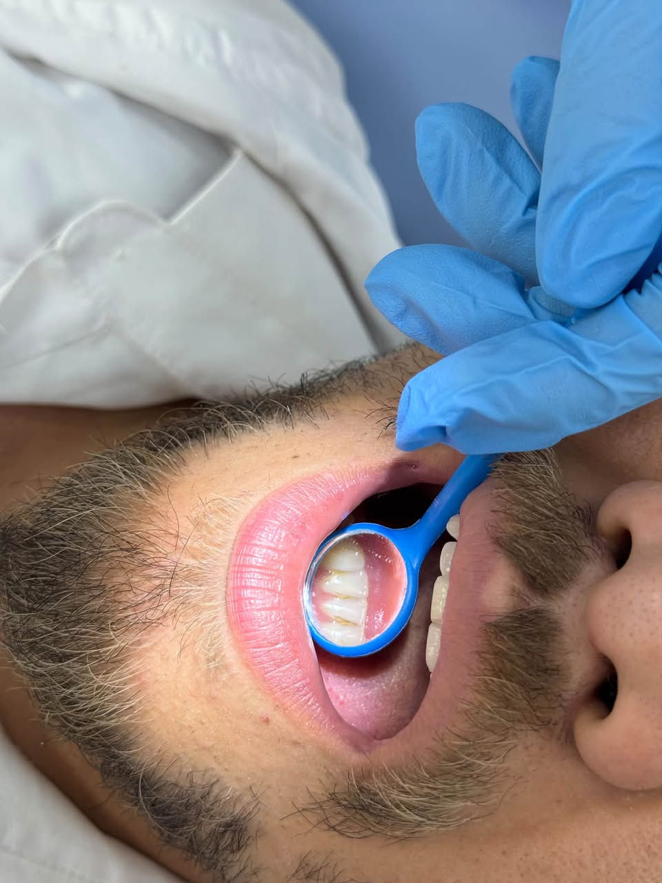 🔺علاج الأسنان مجاني💯
الي عندة هاي الحالات يتواصل ويانا:
***********
📍موقعنا/ عيادات جامعة البيان_ شارع المطار

خدمات مجانية وبأشراف أطباء متخصصين تشمل:
📌 تنظيف الأسنان وإزالة التكلسات
📌 قلع الأسنان التالفة والجذور المتبقية 
📌 حشوات ضوئية تجميلية 
📌حشوات جذور للأسنان الامامية 
📌 تعويض الأسنان المفقودة بطقم كامل
📌علاج حالات أسنان الاطفال 
📌زراعة اسنان بأسعار مناسبة 
📌تقويم  لبعض حالات الأسنان

نص مكتوب في الصور:
- Lower 7
