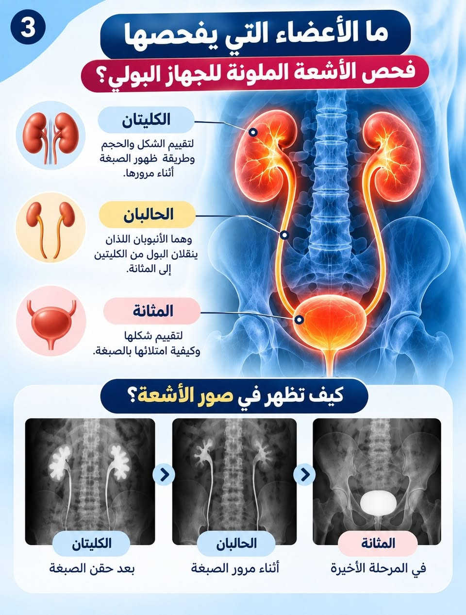 أشعة ملونة • الجهاز البولي • مستشفى الزهراء الأهلي