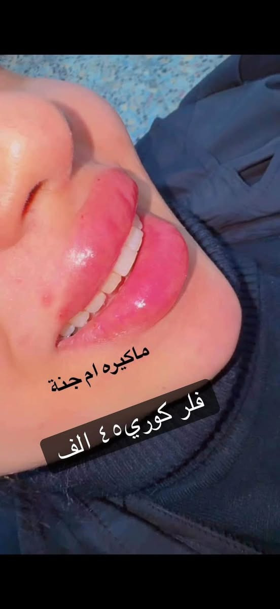 خصم ٢٥٪ • فيلر بوتكس • الزعفرانية