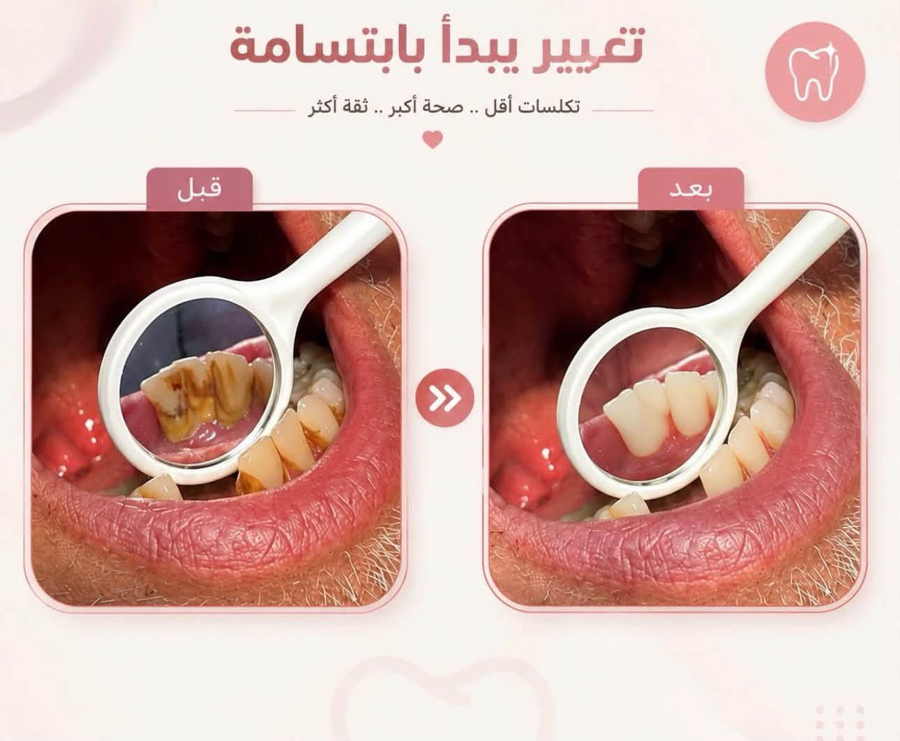 طقم متحرك • علاج مجاني • حي الحسين