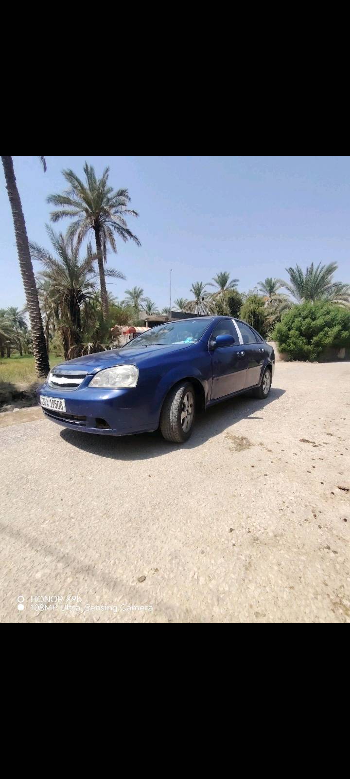 اوبتره فورنزه • ٢٠٠٨ • مكينه وكير بكفاله