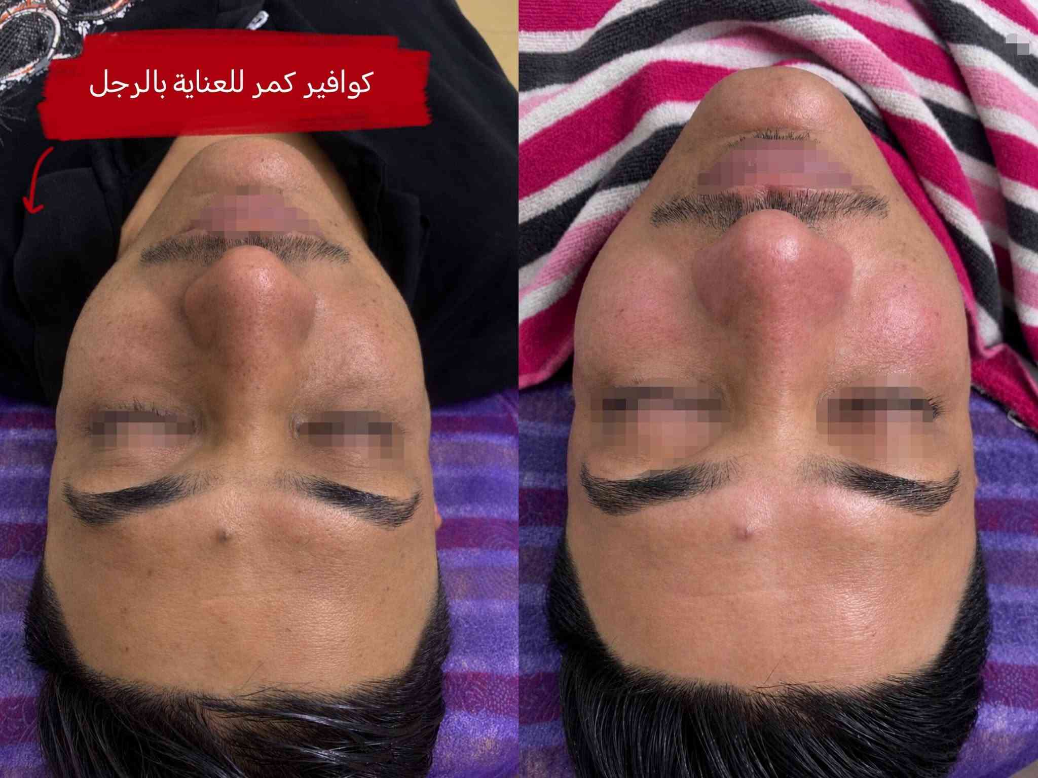 كوافير رجالي • عناية بالرجل • قبل وبعد