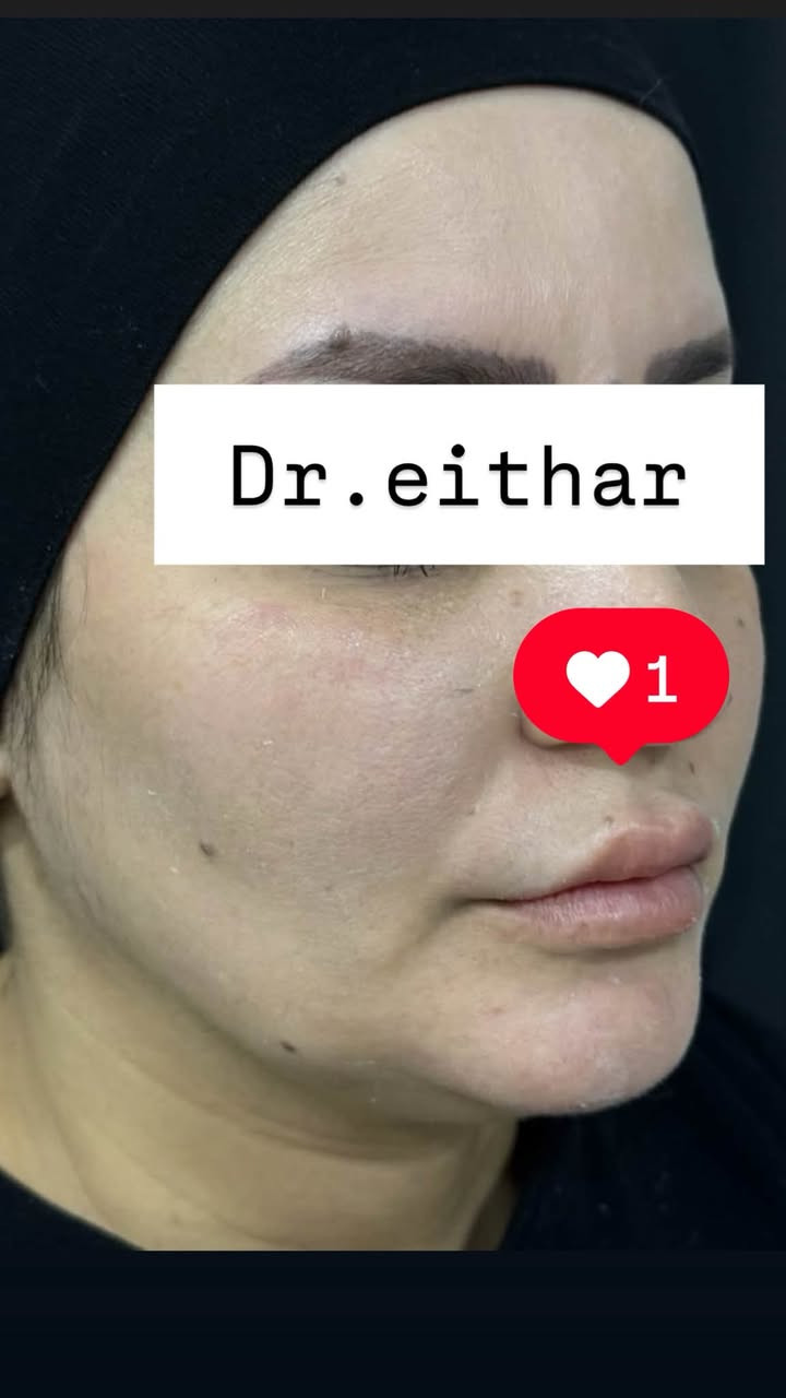 شد لفتنك الوجه بالمحفزات  وفلر شفه  بالفلر الايطالي 🔥🔥🔥
عروووض للكادر التدريسي والخريجات والموظفات والعروسات  ثبتتهه الكم بالستوري بالهايلايت وببوست اعلى الصفحة ✨✨

د.ايثار سامي عبد الامير
واسط الكوت الهوره مجمع القبطان طابق اول 

الحجز***********

نص مكتوب في الصور:
- Dr.eithar 1