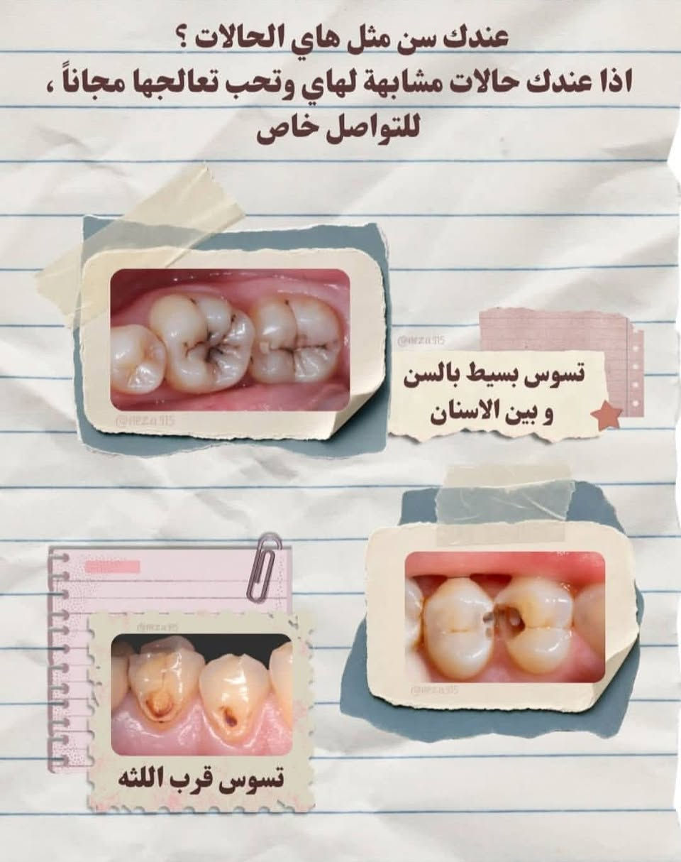 خدمات أسنان مجانية • قلع وجذور • كربلاء طريق الحر