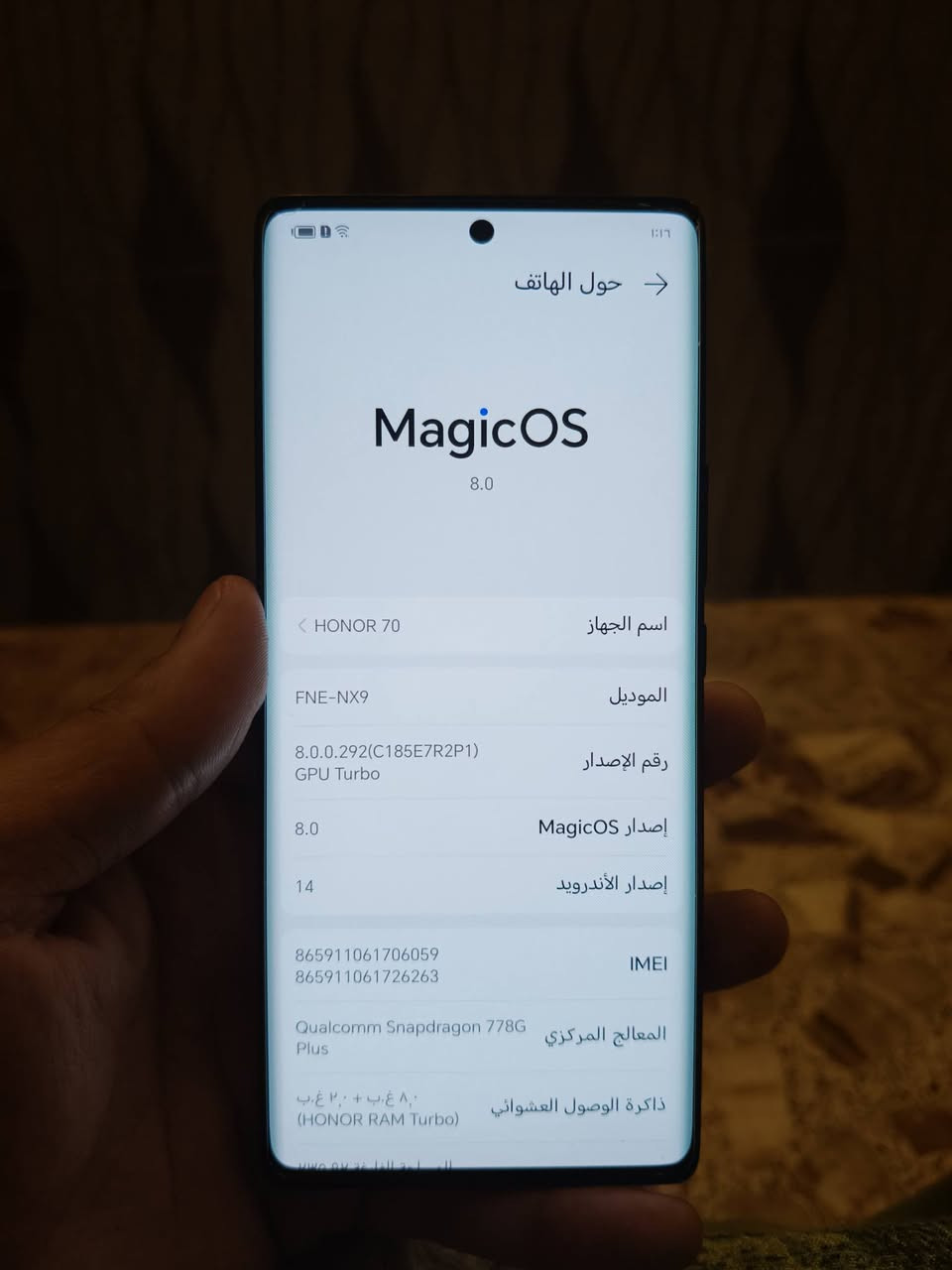 السلام عليكم 
هونر 70 للبيع نظيف 
ذاكرة 256
غراض كامل نقص شاحنه 
بي فطر بالظهر فقط والظهر مالته يتبدل ب 15 الف ب اي مكان 
للبيع المكان بغداد الغزالية 
*********** واتساب واتصال
ماعرف اسعاره انطي سعرك بتعليق او ع واتس عجبني ابيعلك وخادم للكل
