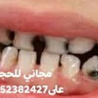 جلسات فلورايد • عيادة الأطفال • حجز