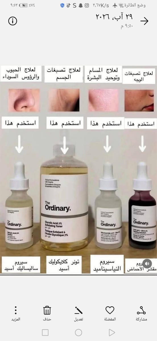 ✨ لأنكِ تستحقين الأفضل ✨
نوفر لكم مواد تجميل أصلية 100% بجودة مضمونة وأسعار مناسبة.
كل منتجاتنا مختارة بعناية لتمنحكِ أفضل نتيجة وثقة بكل استخدام. 💄🌸
📦 التوصيل متوفر
📞 للاستفسار والطلبات: ***********
لا تضيعي الفرصة، دللي نفسكِ بمنتجات أصلية تفرق معكِ من أول استخدام. 💕
