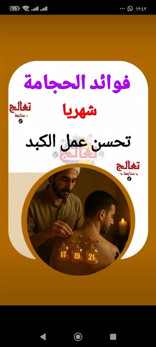 حجامة شهرية • تحسين النوم • تخفيف صداع