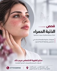 الذئبة الحمراء • فحوصات مناعية • القاسم