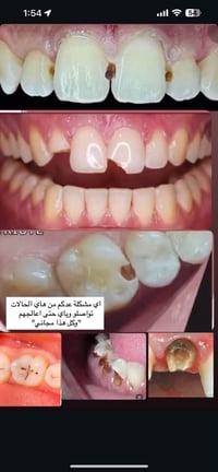 الدورة شارع المصافي • علاج اسنان مجاني • طقم اسنان مجاني