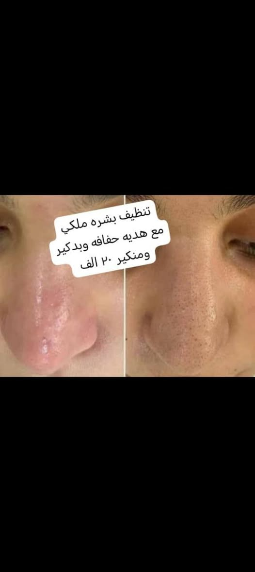 السلام عليكم
هلو بنات 
عروض البشره والسكن كير فدشي لمده اسبوع 
متواجدين بالصالون لحد الساعه ٩مساءً
العنوان فلكه سويب شارع السايدين مقابيل الحسينيه اهل البيت عليهم السلام
 صالون كوثر بيوتي  
 قرب الوكيله ام واثق بس الصالون ع الشارع مقابيل الحسينيه
للحجز واتساب ***********
***********
