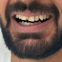 طويريج • عيادة أسنان • تقويم أسنان