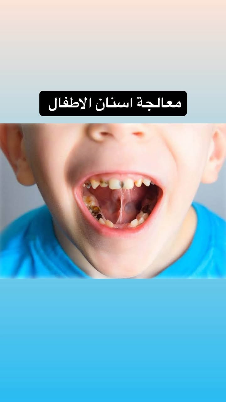 السلام عليكم العلاج مجاني بالكامل تحت اشراف اطباء مختصين
تتوفر ايضاً زرعات الاسنان باسعار مناسبة
الي يحب يتفضل يتواصل ويايه واتس اب 

‭+٩٦٤ ٧٨٣ ٨٧٩ ٨١٧٤‬

نص مكتوب في الصور:
- Dr. Elaph Hafid
- الدكتورة إيلاف حافظ
- قلع الأسنان والجذور التالفة وسن العقل
- تنظيف الأسنان وازالة التكلسات
- معالجة التسوس بحشوات ضوئية للأسنان
- تعويض الأسنان المفقودة بطقم متحرك جزئي وكامل
- تقويم الاسنان
- حشوات الجذور
- معالجة أسنان الأطفال
- عيادات جامعة البيان/شارع مطار بغداد الدولي/قرب ساحة عباس ابن فرناس
- العلاج مجاني بالكامل تحت اشراف اطباء مختصين
- ***********
- معالجة اسنان الاطفال
- تعويض الاسنان المفقوده بطقم جزئي وكامل
- قلع الاسنان والجذور التالفة وسن العقل
- تنظيف الاسنان من التكلسات العميقة