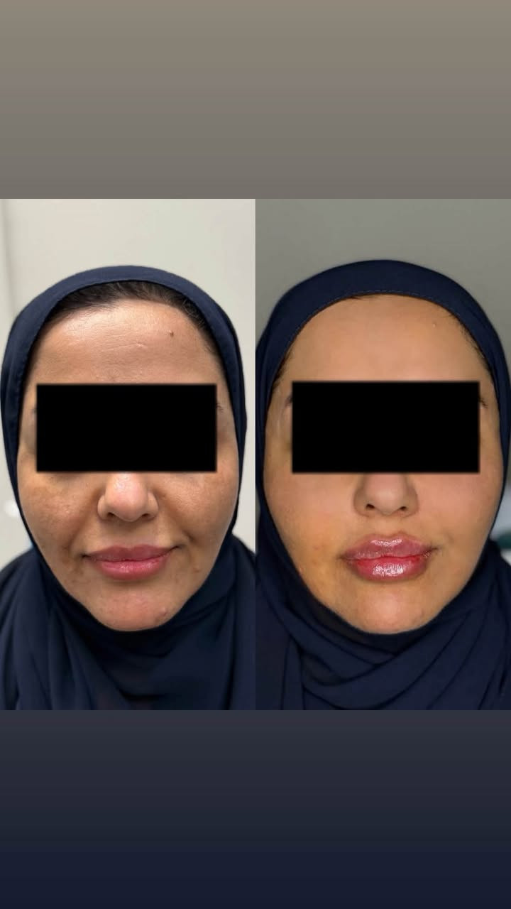 عيادة بتول • تجميل لاجراحي • البساتين
