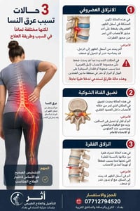 علاج عرق النسا • تأهيل منزلي • نساء بغداد