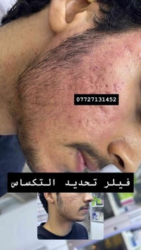 تكساس رجالي • فيلر • سكن كير