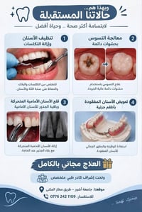 تنظيف أسنان • حشوات دائمة • مجاني بالكامل