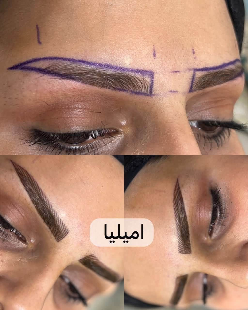 مايكروبلدنك • توريد شفاه • محله 710