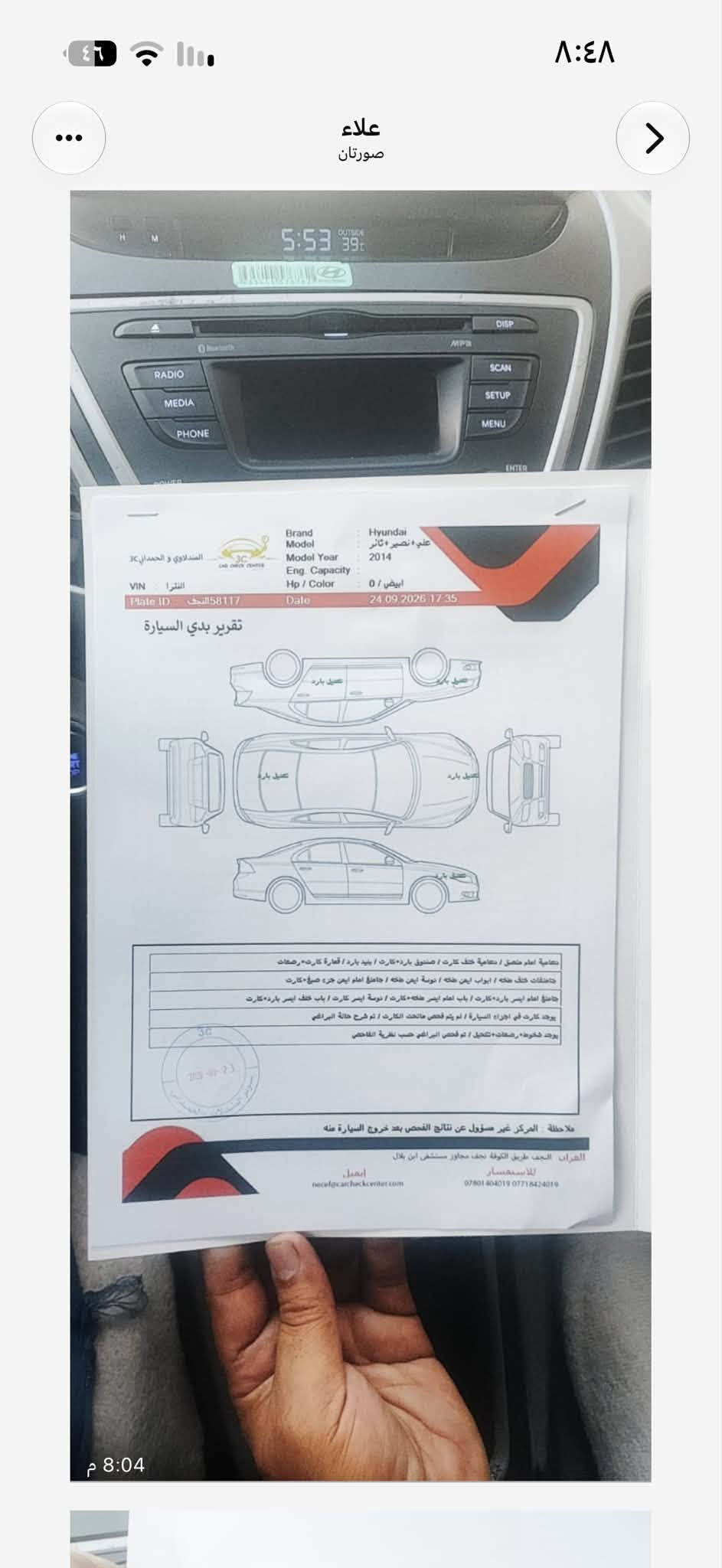 النترا GLS • ٢٠١٤ • عداد مقطوع
